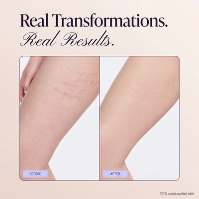 Novioris Body Coverage Perfector